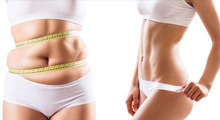 全身痩身とは